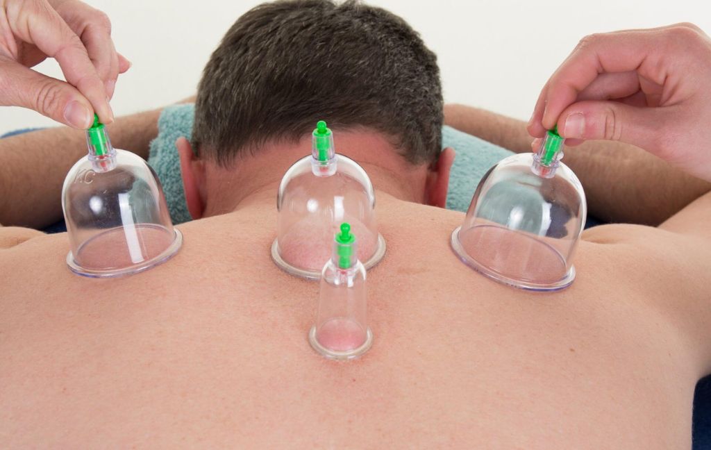 Acupuncture therapy